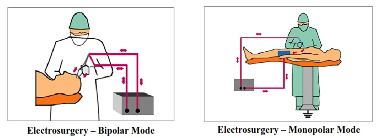 A Study on Performance and Safety Tests of Electrosurgical Equipment
