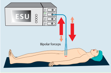 电外科设备的研究现状与未来展望