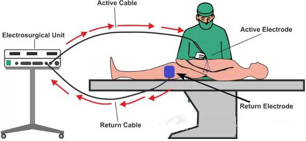 高频电刀的使用及注意事项